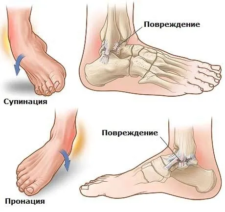 симптоми