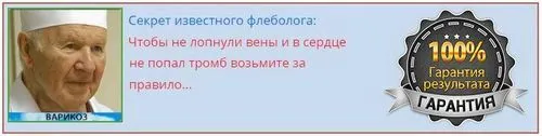 біль в ногах при варикозі симптоми