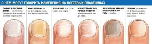 як вилікувати хворі нігті на ногах