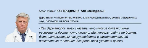свербить