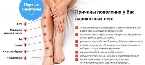 біль в ногах при варикозі симптоми