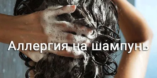 як лікувати алергію на шампунь