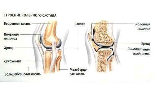 як лікувати розтягнення в колінному суглобі