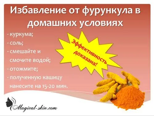 Абсцедирующий фурункул: що це таке і як лікувати абсцедирующий фурункул фото оперативне лікування передбачає