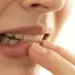 як лікувати кісту на яснах