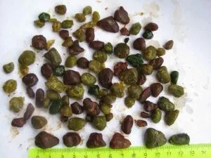 як лікувати каловий живіт