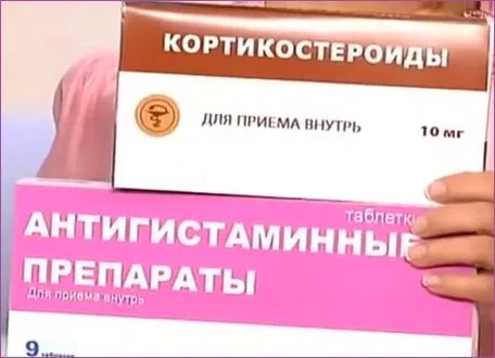 себорея