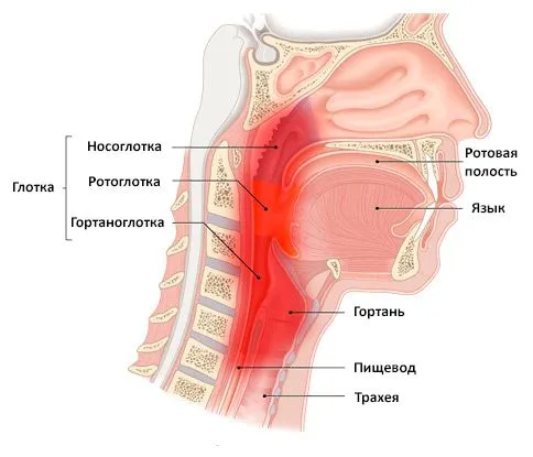 як лікувати фарингіт народними методами