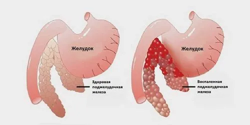 залозу