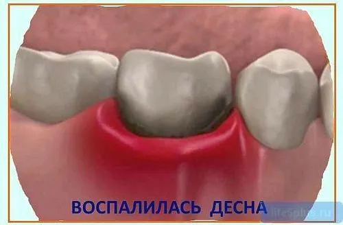 зуб
