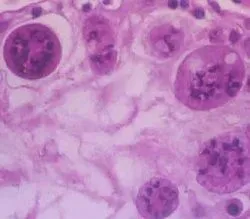 вагітність