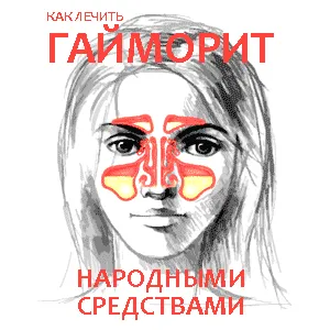 гайморит як лікувати вдома