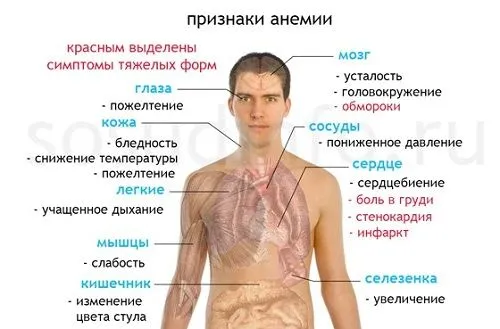 як лікувати анемію