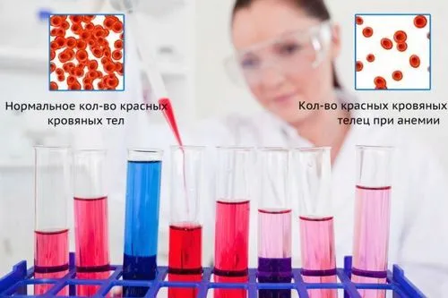 Анемія у дітей: причини, симптоми, діагностика, лікування, профілактика... анемія дітей причини симптоми лікування діагностика профілактика гемоглобін щільність залізодефіцитна догляд дієта вітаміни народні засоби недокрів'я визначити