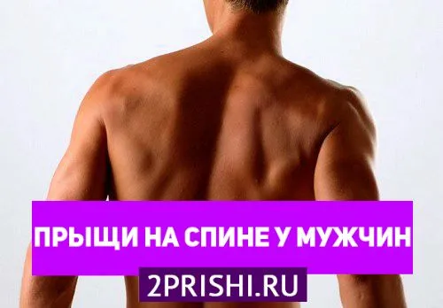 як лікувати прищі у чоловіків