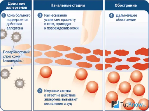догляд за волоссям