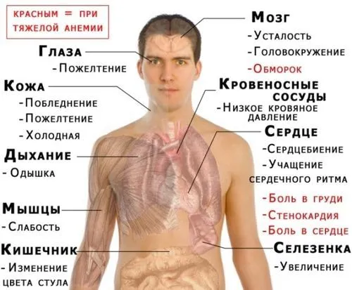 Анемія у дітей: причини, симптоми, діагностика, лікування, профілактика... анемія дітей причини симптоми лікування діагностика профілактика гемоглобін щільність залізодефіцитна догляд дієта вітаміни народні засоби недокрів'я визначити