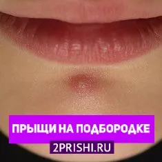 Прищі на підборідді у чоловіків: причини появи як лікувати прищі на бороді