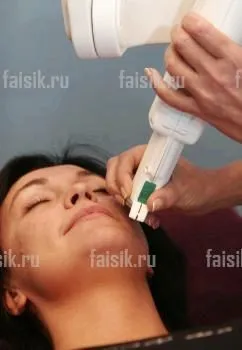 Лікування прищів лазером як лікувати прищі лазером