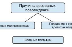 вилікувати гастрит без антибіотиків