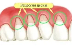 перший по зубам