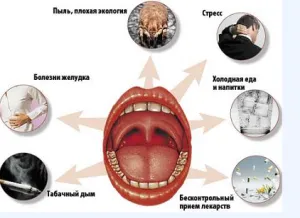 Гострий фарингіт: причини і розвиток як вилікувати фарингіт гострий
