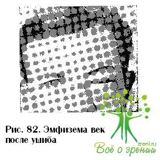 зазвичай