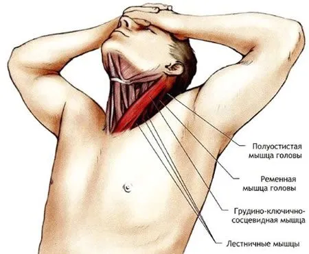 лікування розтягнення м'язів шиї