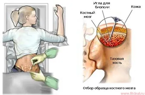 як лікувати анемію без ліків
