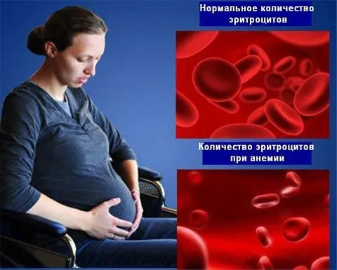 як лікувати анемію без ліків