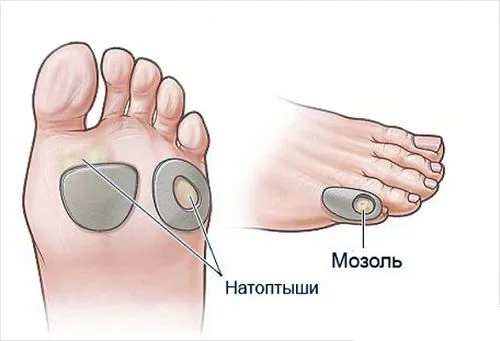 нога