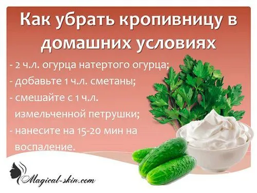 як лікувати кропивницю при вагітності