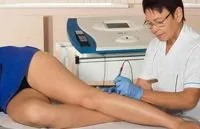 Варикоз - симптоми як лікувати внутрішній варикоз