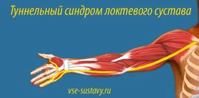 як лікувати забій ліктьового нерва