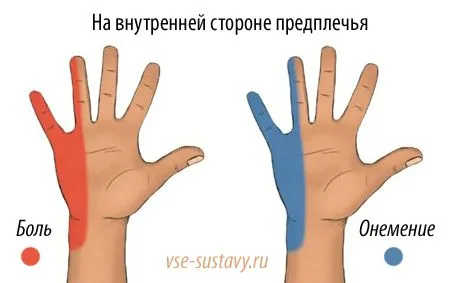 як лікувати забій ліктьового нерва