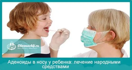 як вилікувати аденоїди у дитини народними засобами