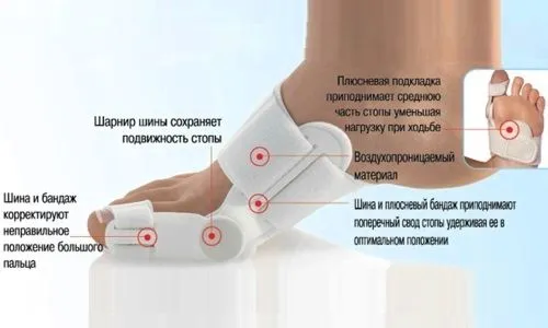 Бурсит великого пальця стопи (ноги): причини, симптоми, лікування ніж лікувати бурсит великого пальця ноги