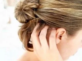 як лікувати себорею в домашніх умовах
