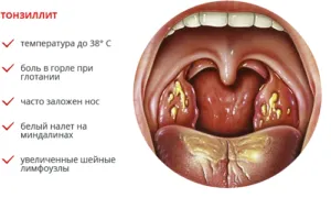 ніж лікувати температуру дитині