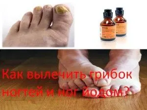 кошти з йоду