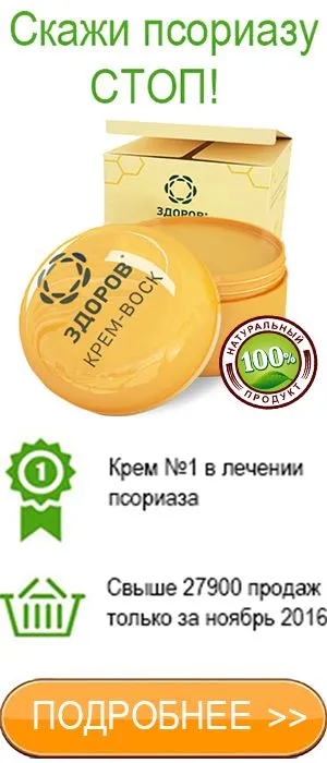 як лікувати себорейний псоріаз