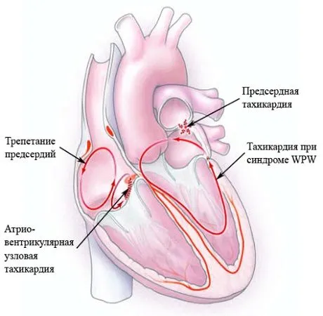 хвороби