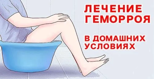 ванночки від геморою