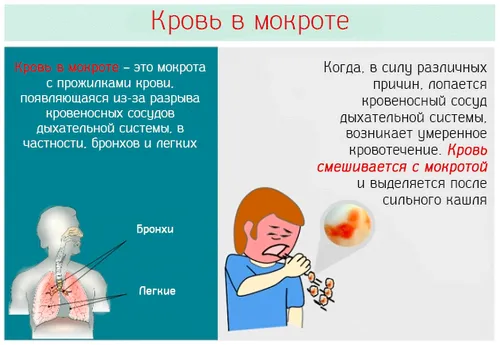як лікувати мокротиння з кров'ю