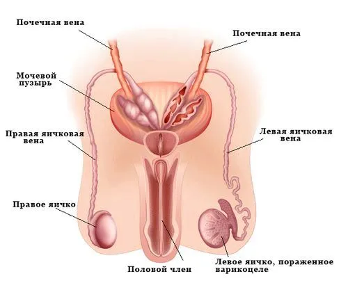 як лікувати варикоз 1 ступеня