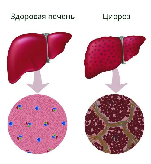 лікування