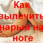 Як вилікувати нарив на нозі як вилікувати нарив на нозі
