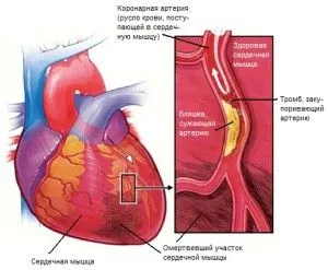 Лабільність артеріального тиску як лікувати нестабільний тиск