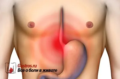 езофагіт