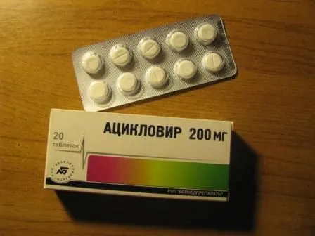 Чим лікувати вітрянку вилікувати вітрянку за тиждень